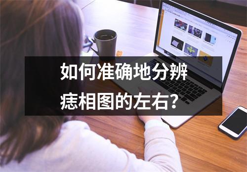 如何准确地分辨痣相图的左右？